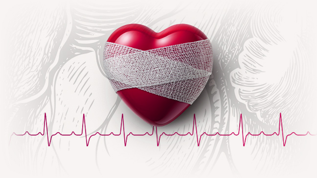 What's your heart health IQ?