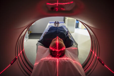 This simple scan gives powerful insight into heart risk 