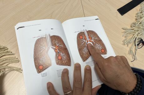 Lung cancer is showing up in younger adults and smoking isn’t the only cause