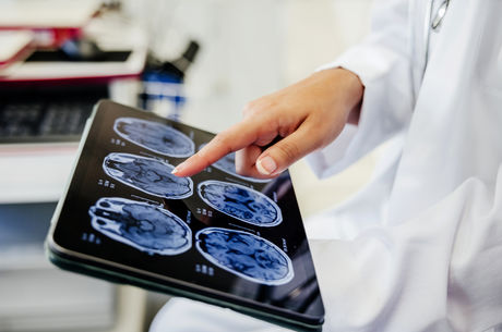 Close-up Shot of a Doctor&#039;s Hand Pointing on Brain Scan Images on Digital Tablet