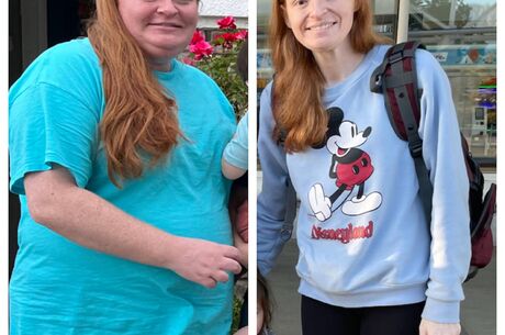 Breaking the cycle: A mother’s journey through weight loss surgery