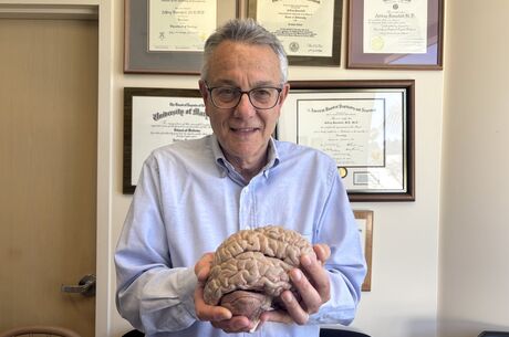 What you should know about brain health, insights from a neurologist