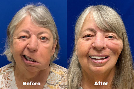 Woman gets her smile back after losing it for four years