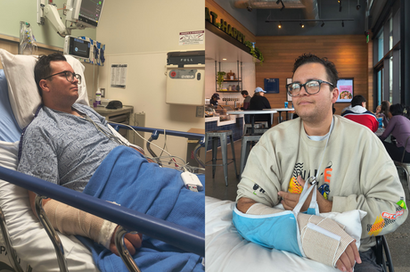 From misdiagnosis to saved wrist: how LLUH’s ortho-oncology saved a hand from amputation