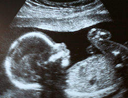 baby ultrasound