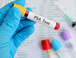 My PSA is elevated — what happens next?