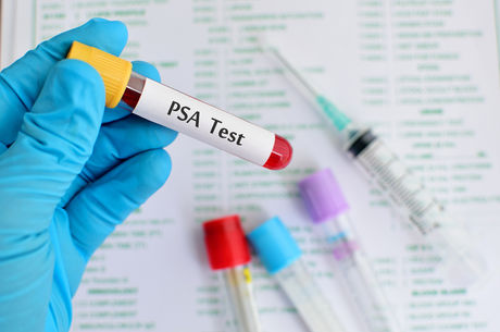 My PSA is elevated — what happens next?
